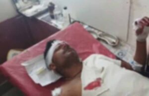 किसान पर शेर ने किया हमला, सिर, कंधे और हाथ में आई गंभीर चोट