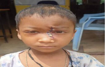 पिता के साये और आर्थिक तंगी के बीच चिरायु योजना बनी सहारा,अंजलि को मिला नया जीवन