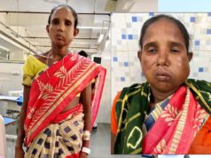 रायपुर: संजीवनी बना मेगा सुपर स्पेशलिटी हेल्थ कैंप, बुधरी मड़कम को मिला नया जीवन