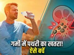 गर्मी में बढ़ा किडनी स्टोन का खतरा, डिहाइड्रेशन बन रहा बड़ा कारण