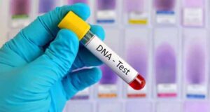 पितृत्व विवाद पर सुप्रीम कोर्ट का बड़ा फैसला, DNA टेस्ट को बताया न्याय के लिए जरूरी