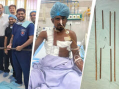 शरीर में आर-पार घुसे 4 लोहे के सरिये, KGMU के डॉक्टरों ने साढ़े आठ घंटे की सर्जरी से बचाई मजदूर की जान