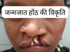सफल सर्जरी से भीमे हेमला के चेहरे पर लौटी मुस्कान